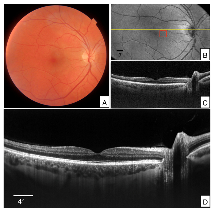 Fig. 3