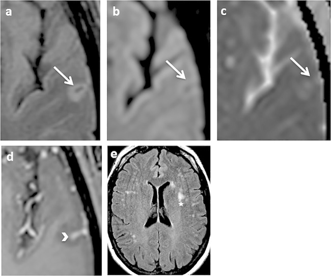 FIG 1