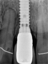 Fig. 13