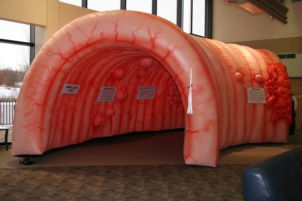 The figure is a walk-through, inflatable model of a human colon measuring 20 feet wide by 32 feet long by 14 feet high. The model depicts healthy tissue as well as 3-dimensional precancerous and cancerous growths protruding from the walls of the model, along with display signs that give information on colorectal cancer screening and prevention.