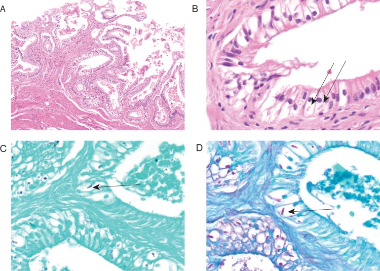 Figure 1