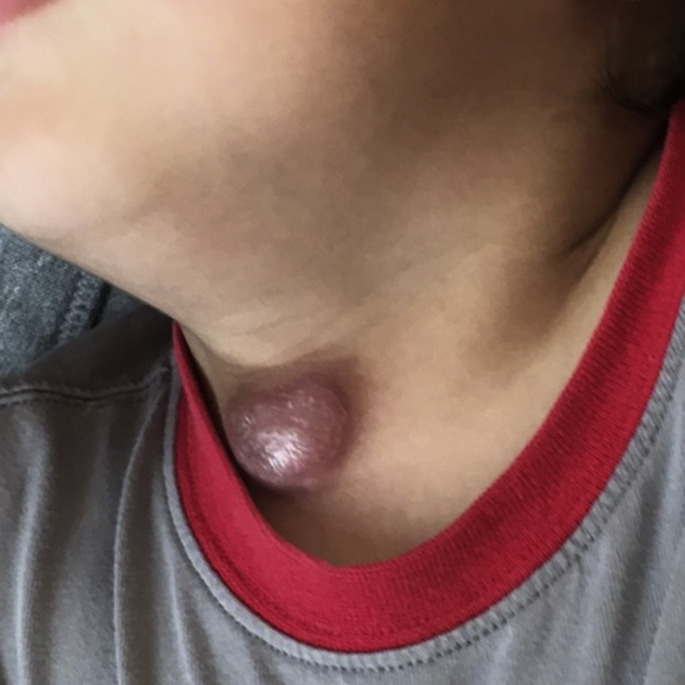Fig. 4