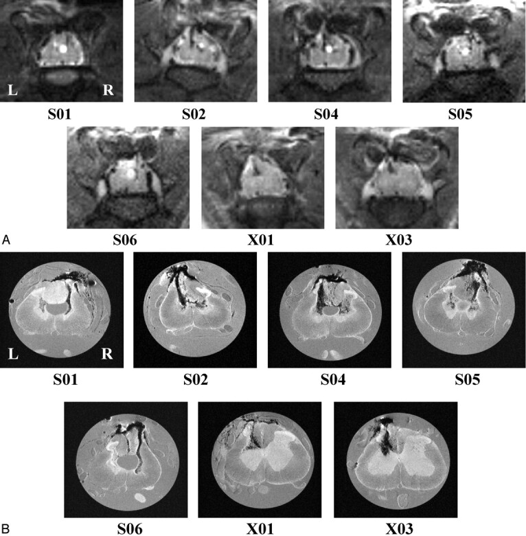 Fig 3.