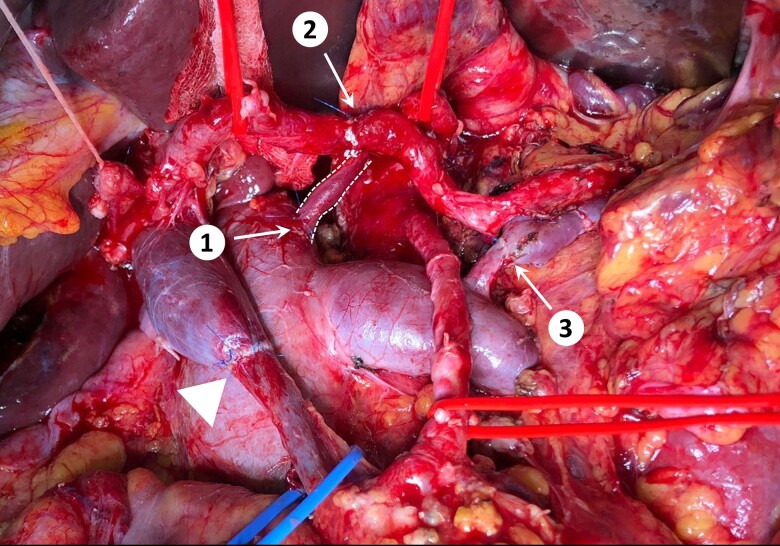 Figure 2.
