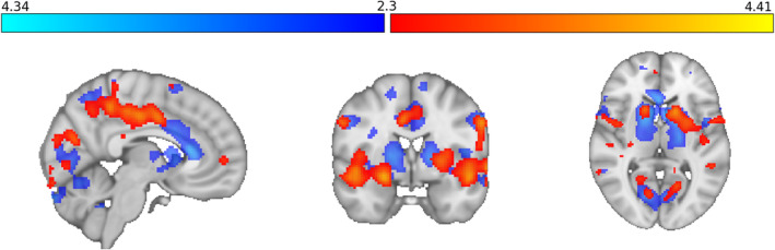 FIGURE 3