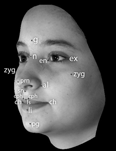 Figure 1. Soft tissue points used in this study.