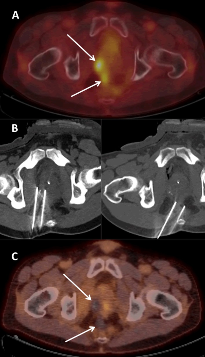 Fig. 1