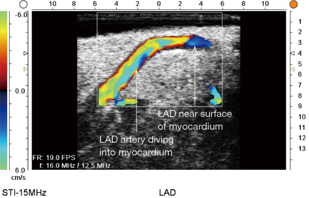 Figure 16