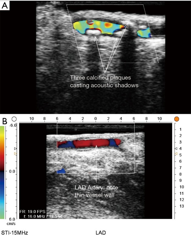 Figure 15