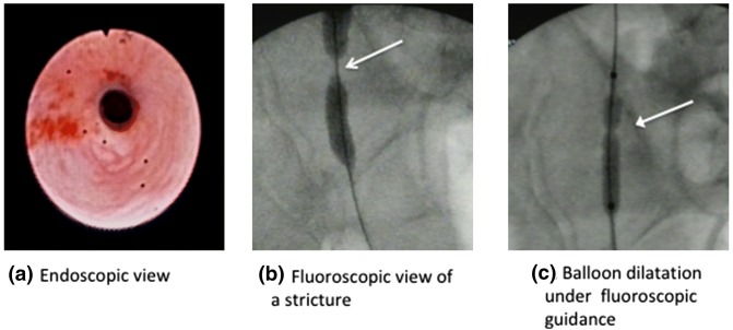 Fig. 1