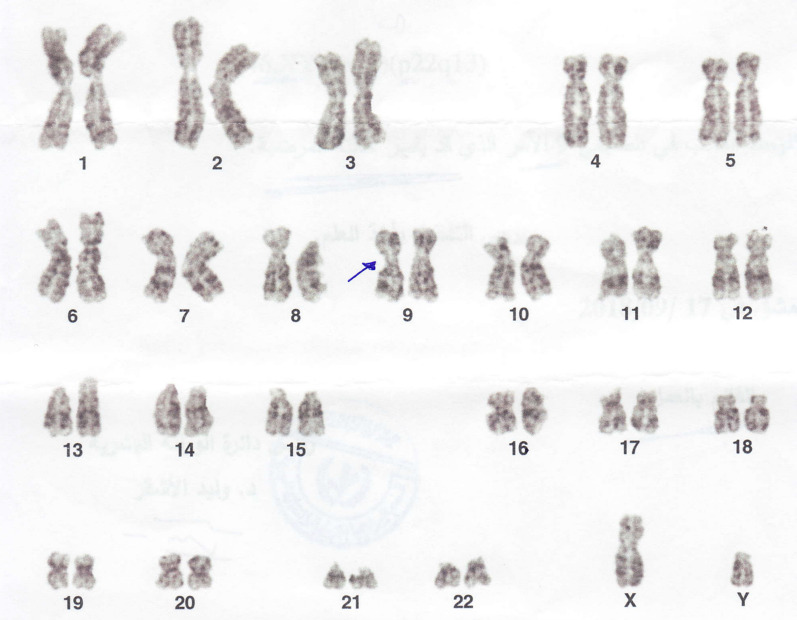 Fig. 3