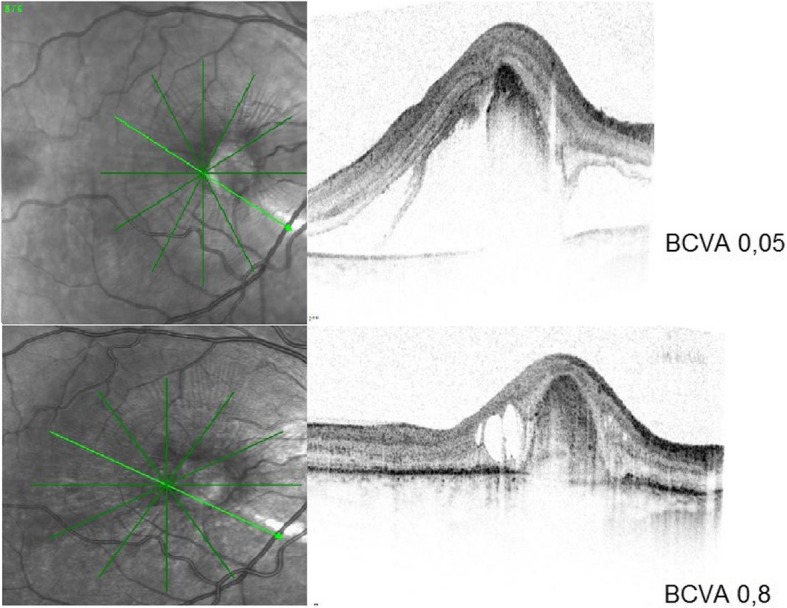 Fig. 2