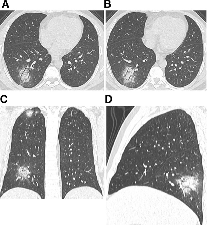 Fig 5