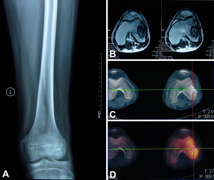 Fig. 1A–D