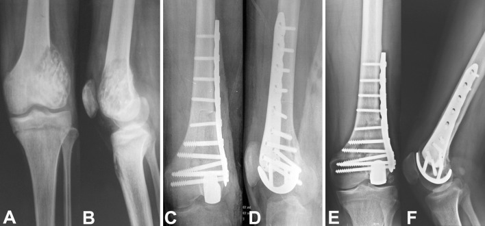 Fig. 5A–F