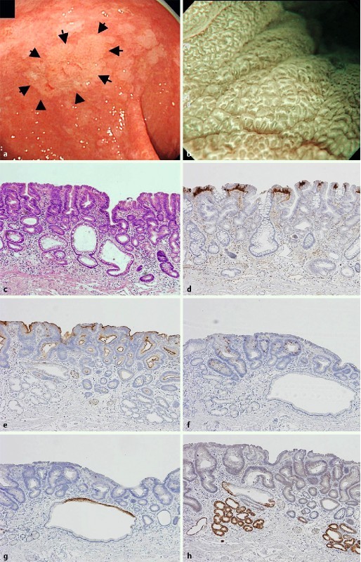 Fig. 1