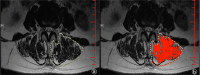 Fig.1