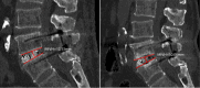 Fig.3