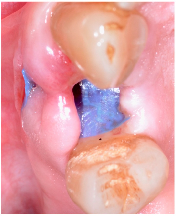 Figure 5