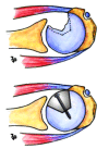 Fig. (4)