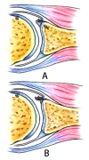 Fig. (18A,B)