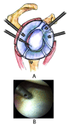 Fig. (11A,B)