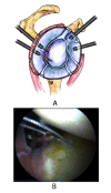 Fig. (13A,B)