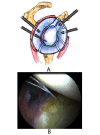 Fig. (12A,B)