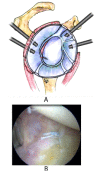 Fig. (16A,B)
