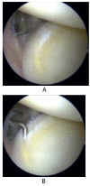 Fig. (9A,B)