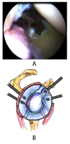 Fig. (10A,B)
