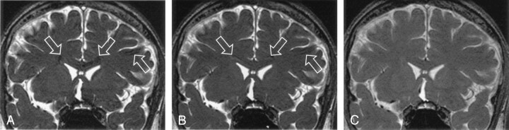 Fig 6.