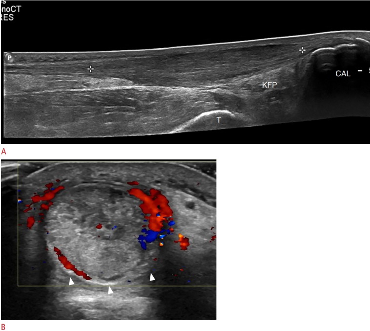 Fig. 13.