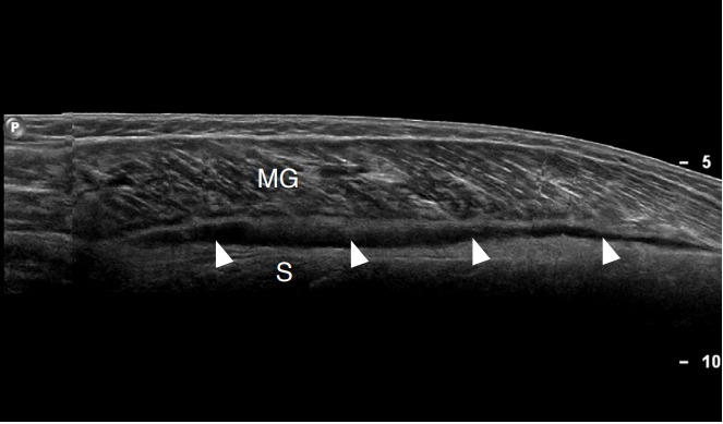 Fig. 11.