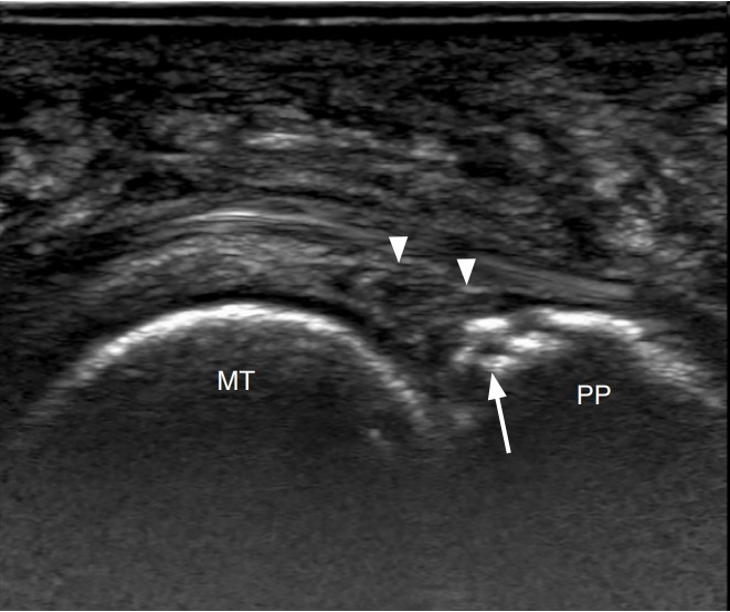 Fig. 22.