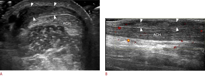 Fig. 12.