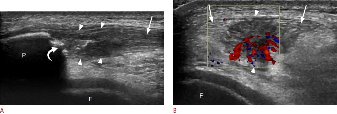 Fig. 9.