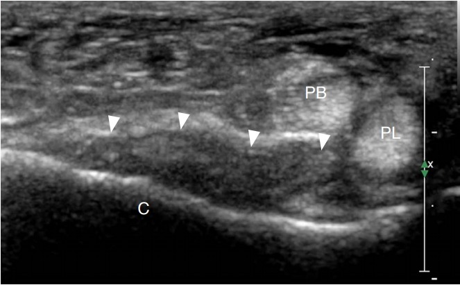 Fig. 18.