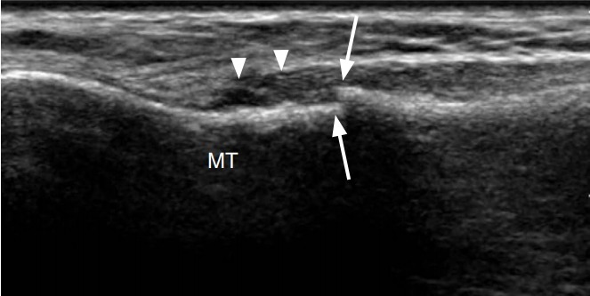 Fig. 23.