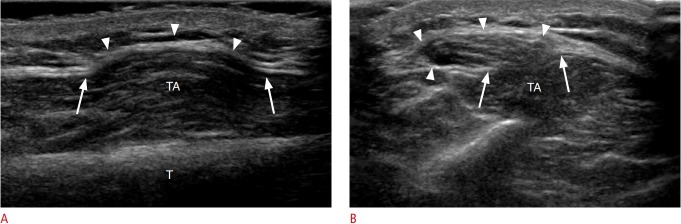 Fig. 20.