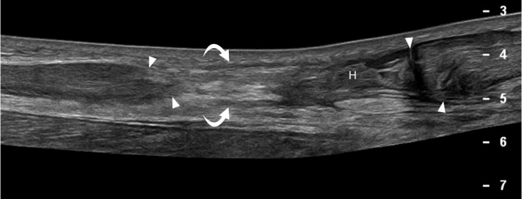 Fig. 14.