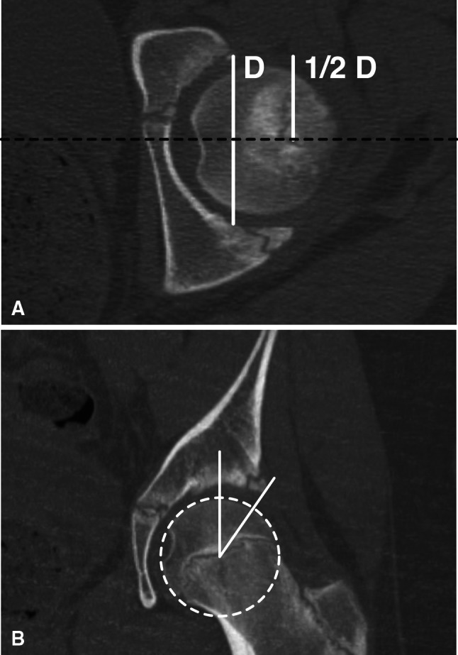 Fig. 3A–B