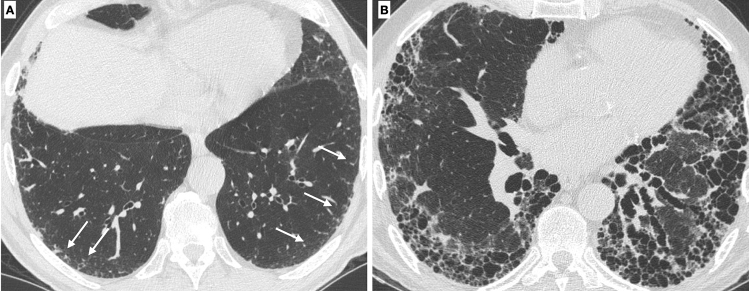 Fig. 13