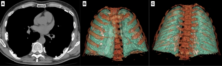 Fig. 16