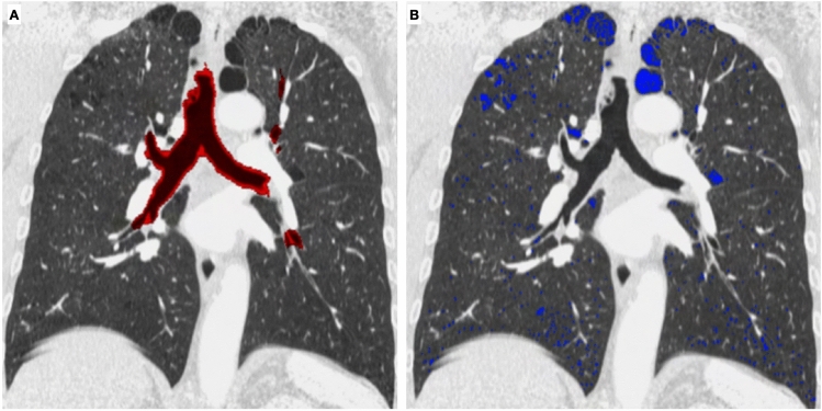 Fig. 11