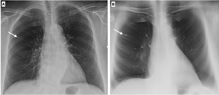 Fig. 14