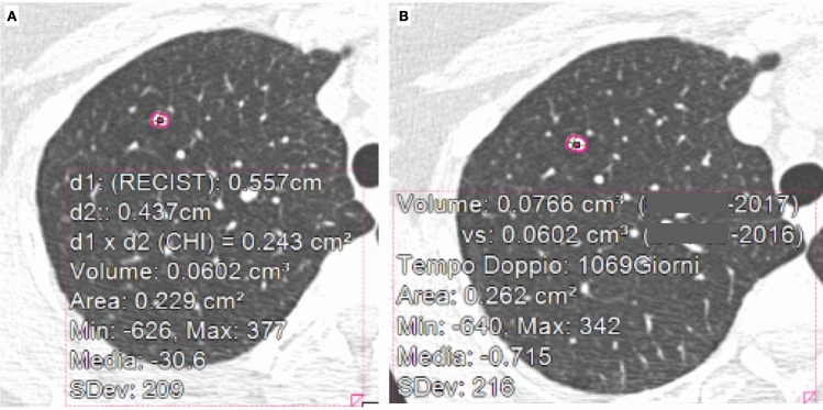 Fig. 15