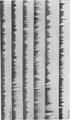 244-1