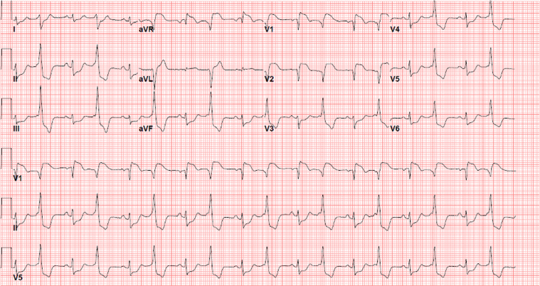 Figure 1