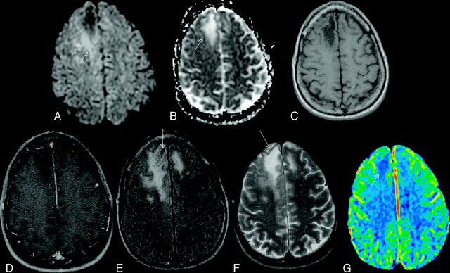 Fig 1.